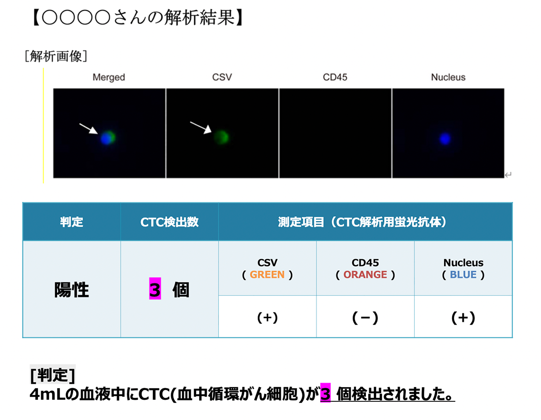 日本国内で分析、CTCの個数がわかる